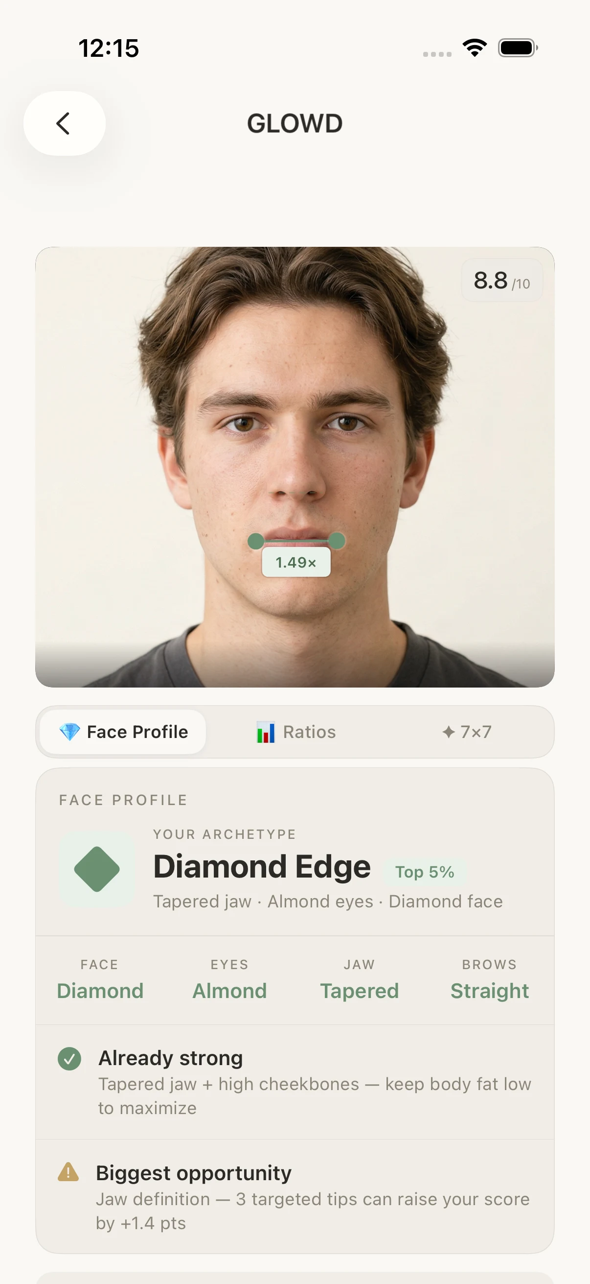Real GLOWD analysis result for a man, showing his measured face profile and Harmony Score